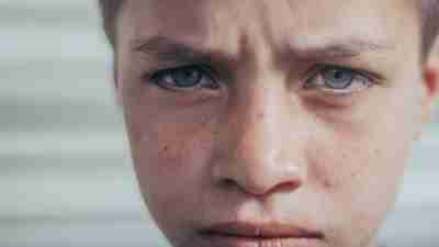 Face of a boy who has been teased or bullied